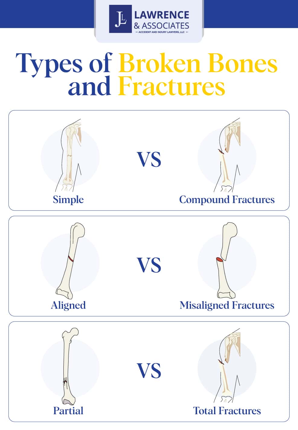 Broken Bone Injury Lawyer